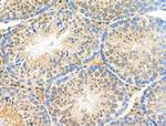 Phospho-FGFR3 (Tyr724) Antibody in Immunohistochemistry (Paraffin) (IHC (P))