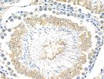 Phospho-FGFR3 (Tyr724) Antibody in Immunohistochemistry (Paraffin) (IHC (P))