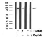 Phospho-FGFR3 (Tyr724) Antibody in Western Blot (WB)