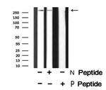 Phospho-ROS1 (Tyr2114) Antibody in Western Blot (WB)