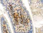 Phospho-ROS1 (Tyr2114) Antibody in Immunohistochemistry (Paraffin) (IHC (P))