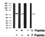 Phospho-SMAD1/SMAD9 (Ser463, Ser465) Antibody in Western Blot (WB)