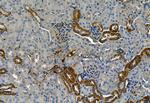 Phospho-TGFBR1 (Thr204) Antibody in Immunohistochemistry (Paraffin) (IHC (P))