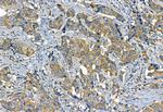 Phospho-TGFBR1 (Thr204) Antibody in Immunohistochemistry (Paraffin) (IHC (P))