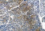 Phospho-TGFBR1 (Thr204) Antibody in Immunohistochemistry (Paraffin) (IHC (P))