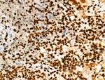 Phospho-SMC3 (Ser1083) Antibody in Immunohistochemistry (Paraffin) (IHC (P))