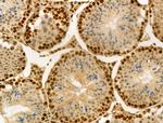 Phospho-SMC3 (Ser1083) Antibody in Immunohistochemistry (Paraffin) (IHC (P))