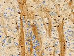 Phospho-BCL-2 (Thr74) Antibody in Immunohistochemistry (Paraffin) (IHC (P))