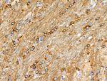 Phospho-BCL-2 (Thr74) Antibody in Immunohistochemistry (Paraffin) (IHC (P))