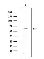 Phospho-DNM1L (Ser616) Antibody in Western Blot (WB)