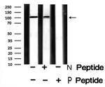 Phospho-GluR2 (Tyr876) Antibody in Western Blot (WB)