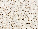 Phospho-MCM2 (Ser27) Antibody in Immunohistochemistry (Paraffin) (IHC (P))