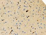 Phospho-MCM2 (Ser53) Antibody in Immunohistochemistry (Paraffin) (IHC (P))