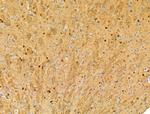 Phospho-Nudel (Thr219) Antibody in Immunohistochemistry (Paraffin) (IHC (P))