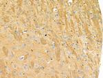 Phospho-Nudel (Thr219) Antibody in Immunohistochemistry (Paraffin) (IHC (P))