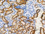 Phospho-NDRG1 (Ser330) Antibody in Immunohistochemistry (Paraffin) (IHC (P))