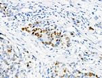 Phospho-NPM1 (Thr237) Antibody in Immunohistochemistry (Paraffin) (IHC (P))