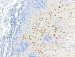 Phospho-NPM1 (Thr237) Antibody in Immunohistochemistry (Paraffin) (IHC (P))