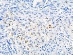 Phospho-NPM1 (Thr237) Antibody in Immunohistochemistry (Paraffin) (IHC (P))