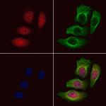 Phospho-NPM1 (Thr237) Antibody in Immunocytochemistry (ICC/IF)