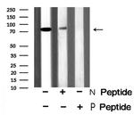 Phospho-p73 (Ser388) Antibody in Western Blot (WB)