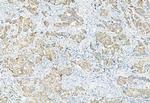 Phospho-PDHA1/PDHA2 (Ser293, Ser291) Antibody in Immunohistochemistry (Paraffin) (IHC (P))