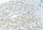 Phospho-PDHA1/PDHA2 (Ser293, Ser291) Antibody in Immunohistochemistry (Paraffin) (IHC (P))