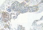 Phospho-PDHA1/PDHA2 (Ser293, Ser291) Antibody in Immunohistochemistry (Paraffin) (IHC (P))