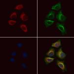 Phospho-PDHA1/PDHA2 (Ser293, Ser291) Antibody in Immunocytochemistry (ICC/IF)