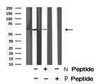 Phospho-PNK (Ser114) Antibody in Western Blot (WB)