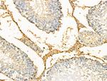 Phospho-Creatine Kinase BB (Ser199) Antibody in Immunohistochemistry (Paraffin) (IHC (P))