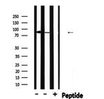 Phospho-PFKP (Tyr52) Antibody in Western Blot (WB)