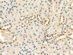 Phospho-EZH2 (Ser476) Antibody in Immunohistochemistry (Paraffin) (IHC (P))