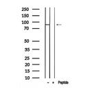 Phospho-EZH2 (Ser476) Antibody in Western Blot (WB)