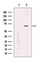 PNK Antibody in Western Blot (WB)