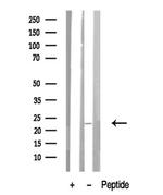 RRAS Antibody in Western Blot (WB)