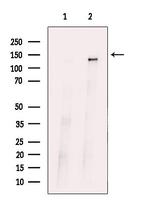 ABL1/ABL2 Antibody in Western Blot (WB)