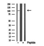 PRK1/PRK2 Antibody in Western Blot (WB)