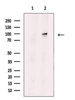 PRK1/PRK2 Antibody in Western Blot (WB)