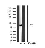 HLA-E Antibody in Western Blot (WB)