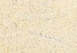 DACH1 Antibody in Immunohistochemistry (Paraffin) (IHC (P))