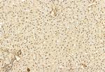 DACH1 Antibody in Immunohistochemistry (Paraffin) (IHC (P))