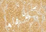 DACH1 Antibody in Immunohistochemistry (Paraffin) (IHC (P))