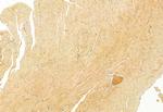 IFT81 Antibody in Immunohistochemistry (Paraffin) (IHC (P))