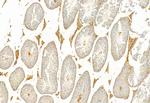 IFT81 Antibody in Immunohistochemistry (Paraffin) (IHC (P))