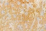 IFT81 Antibody in Immunohistochemistry (Paraffin) (IHC (P))