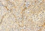 IFT81 Antibody in Immunohistochemistry (Paraffin) (IHC (P))