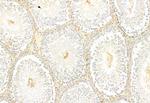 IFT81 Antibody in Immunohistochemistry (Paraffin) (IHC (P))