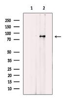 IFT81 Antibody in Western Blot (WB)