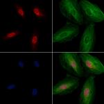 SGTA Antibody in Immunocytochemistry (ICC/IF)